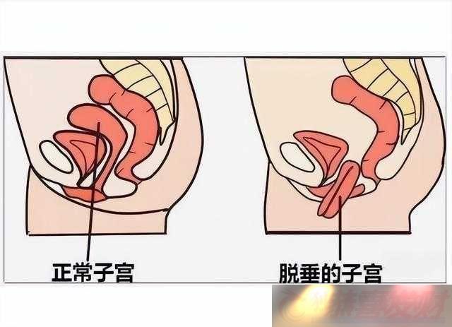 ŮԵͦô£ѴԭƷ